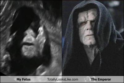 my-fetus-totally-looks-like-the-emperor