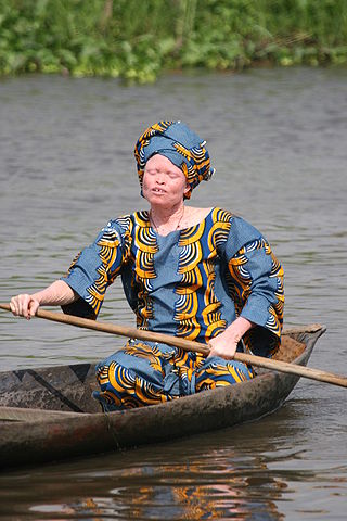 320px-Albino woman in canoe2C Benin