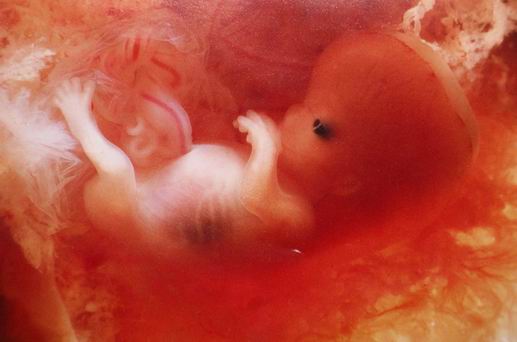 Embryo 10 bis 11 Wochen