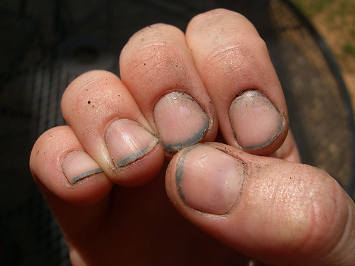 dirty-nails