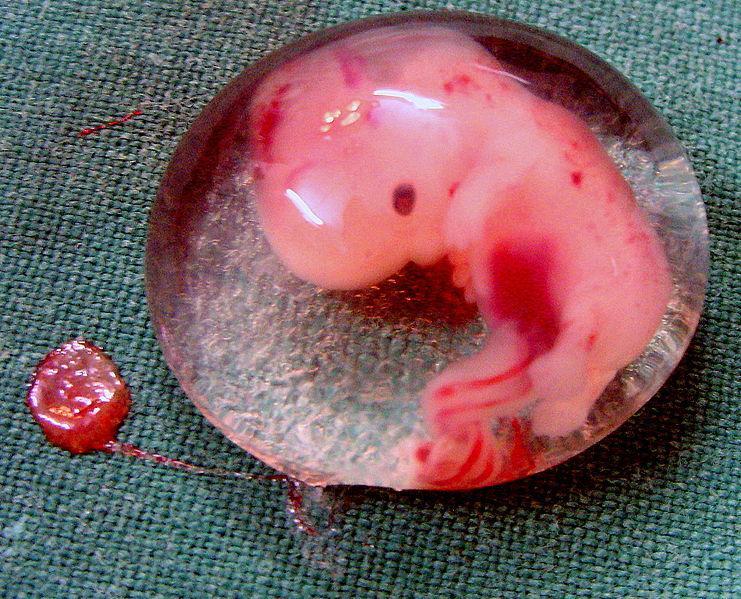 9c55ff 741px-Human Embryo