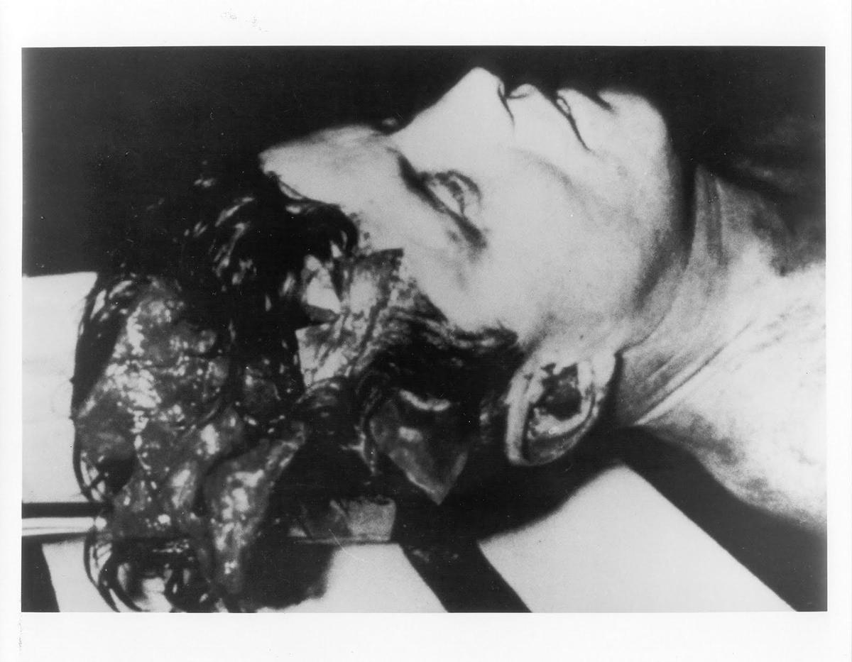 00h. JFK Autopsy Photo
