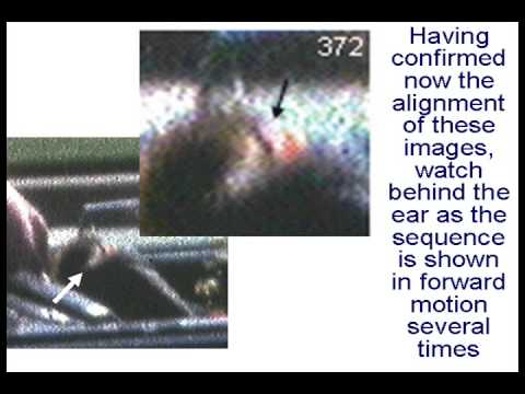 Youtube: JFK Back of Head- Part III -  Visibility of Hind Scalp Tear