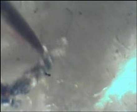 Youtube: Moving Morgellons fibers