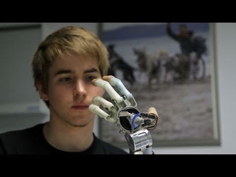 Youtube: Freiwillige Amputation für bionische Prothese