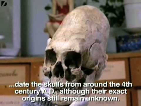 Youtube: Archeologists Discover Strange Elongated Skulls in Russia.