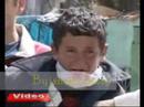 Youtube: How Turkish Ununiformed Policemen Break Arm of a Kurdish Child in Turkey..