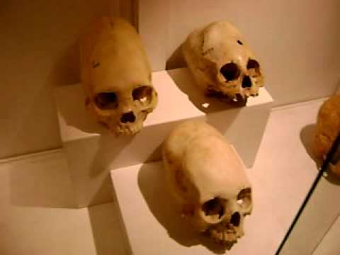 Youtube: Elongated Skulls exhibited in the Incan Museum Part 1 of 2