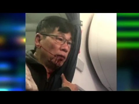 Youtube: New video shows United passenger bleeding after incident