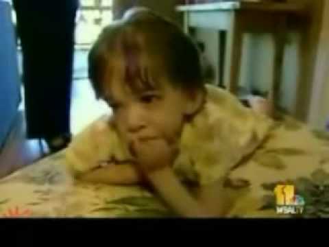 Youtube: Brooke Greenberg - An eternal baby?? - 2005
