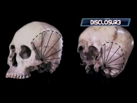 Youtube: Starchild Skull- The SHOCKING DNA Results Are In....WATCH THIS! *HD*