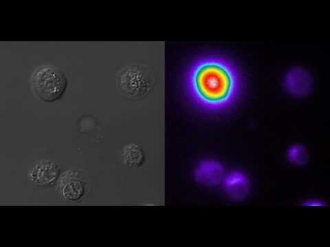Youtube: TNF-induced necrotic L929 cells - Morphology  & calcium release
