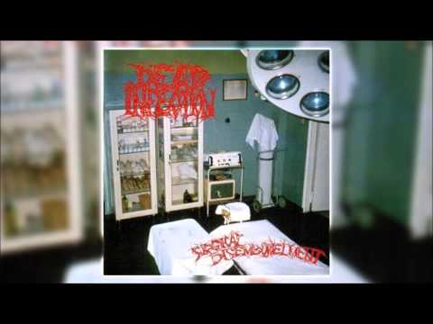 Youtube: Dead Infection  - Surgical Disembowelment (1993) [FULL ALBUM]