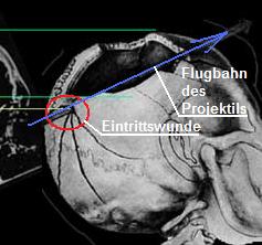 /dateien/gg4378,1295018499,gg43781275477572xraydooum5