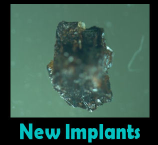 /dateien/gw54481,1245251547,implants