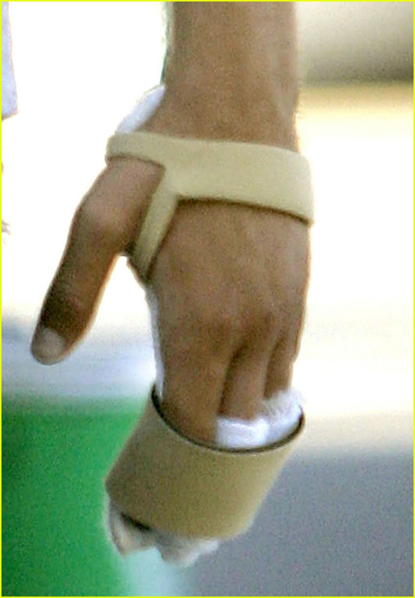 /dateien/np66944,1288556933,shia-labeouf-hand-splint-05