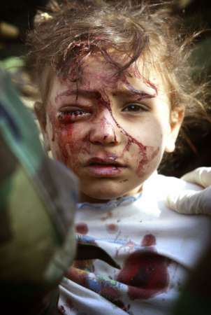 /dateien/pr28907,1231584096,03.29 wounded girl