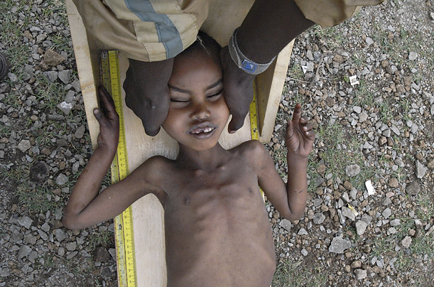 /dateien/pr67801,1289867072,ethiopia hunger 03