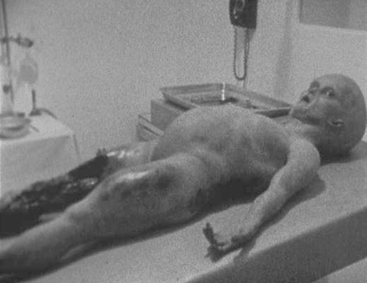 /dateien/uf25902,1281714028,alien-autopsy1