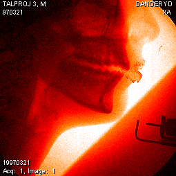 Bilder-Thread uh43048,1262774852,bothred