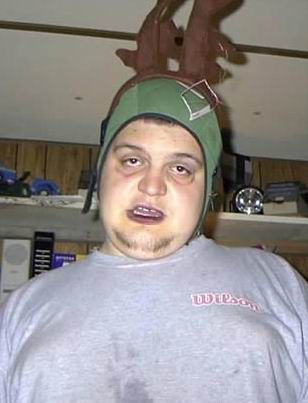 Bilder-Thread uh43048,1264691105,Rudolph The Rednosed Zombie