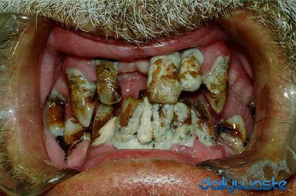 Bilder-Thread uh43048,1264697467,ugly-teeth