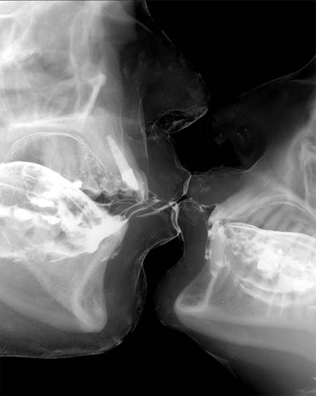 Bilder-Thread uh43048,1266161443,x-ray-kiss