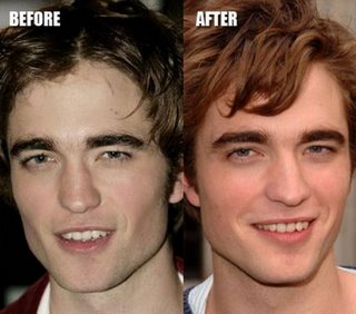 /dateien/uh60603,1278464633,c82ee robert pattinson plastic surgery 2