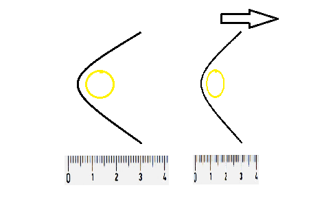 lorentzkontraktion