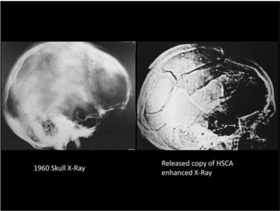 A-Review-of-the-JFK-Cranial-x-Rays-and-P