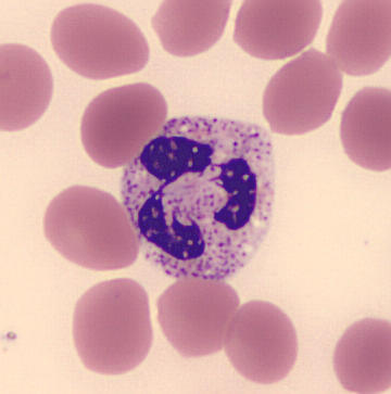 Hem1SegmNeutrophile4