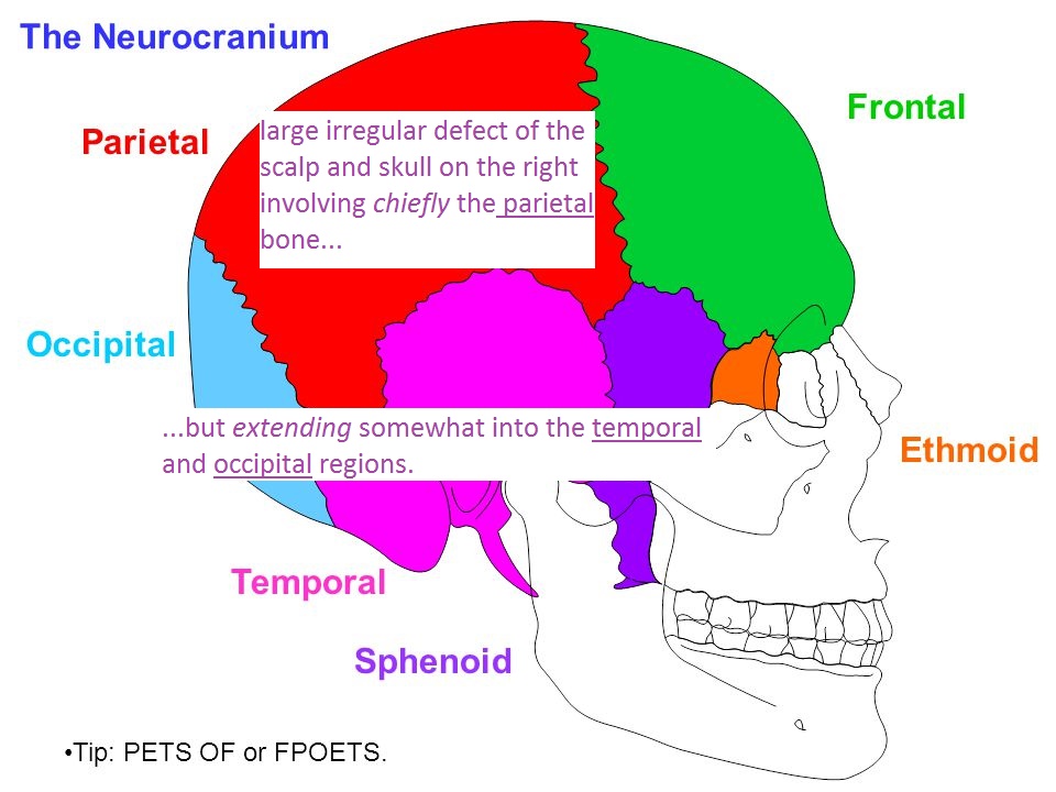 TheNeurocraniumFrontalParietalOccipitalE