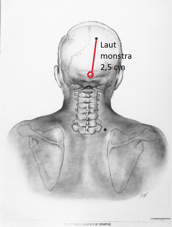 monstradoxneu