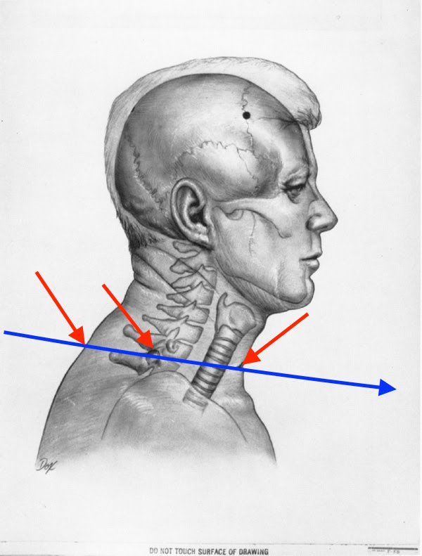 t13a075f22 jfk 20profile 20w 20wound 20s