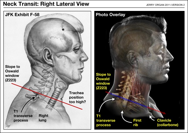 necktransitlateral02
