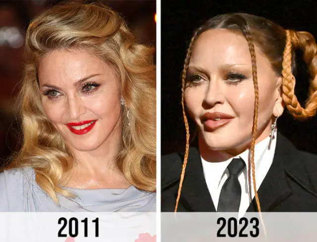 Madonna-Facelift1.webp