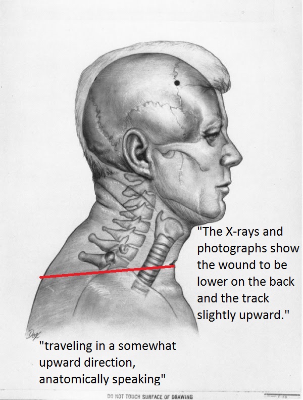 jfk 20profile 20w 20wound 20sites 20and 