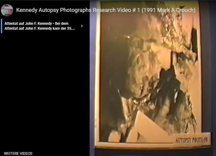 JFK autopsy-Fotos occ