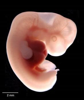 human-embryo