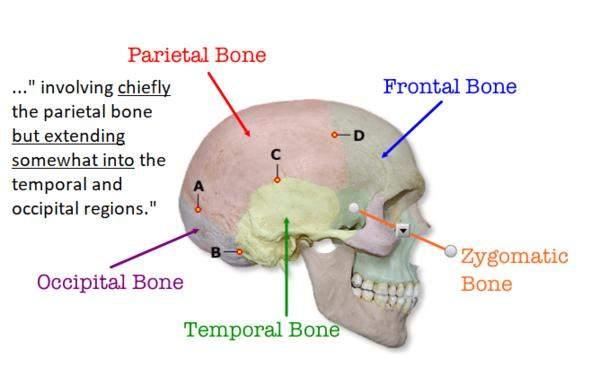 ucvzvlz8oilq parietal-bone.png conv