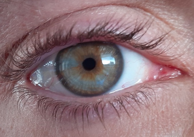 eye