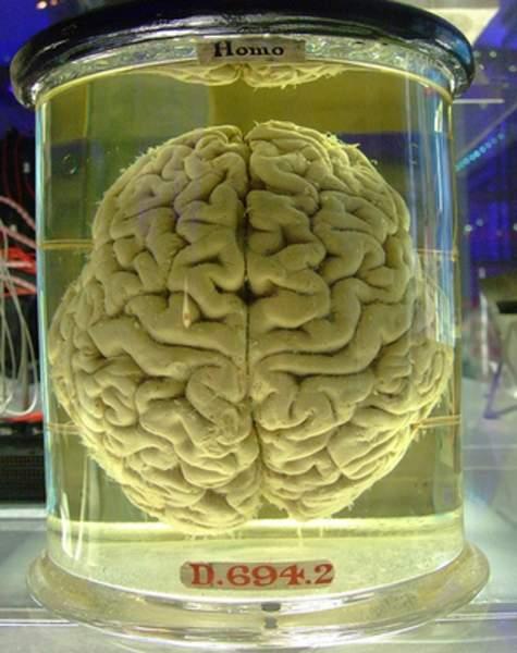 csm formaldehyde-brain 020f78d04c