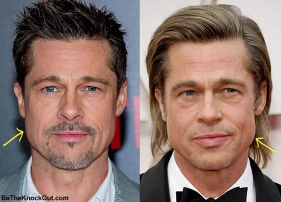 Брэд питт операция. Brad Pitt jawline. Брэд Питт скулы. Брэд Питт челюсть. Брэд Питт jawline.