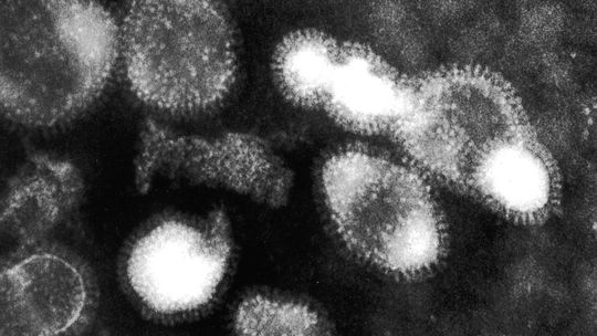 virus vogelgrippe h5n1 540x304