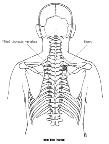 back diagram