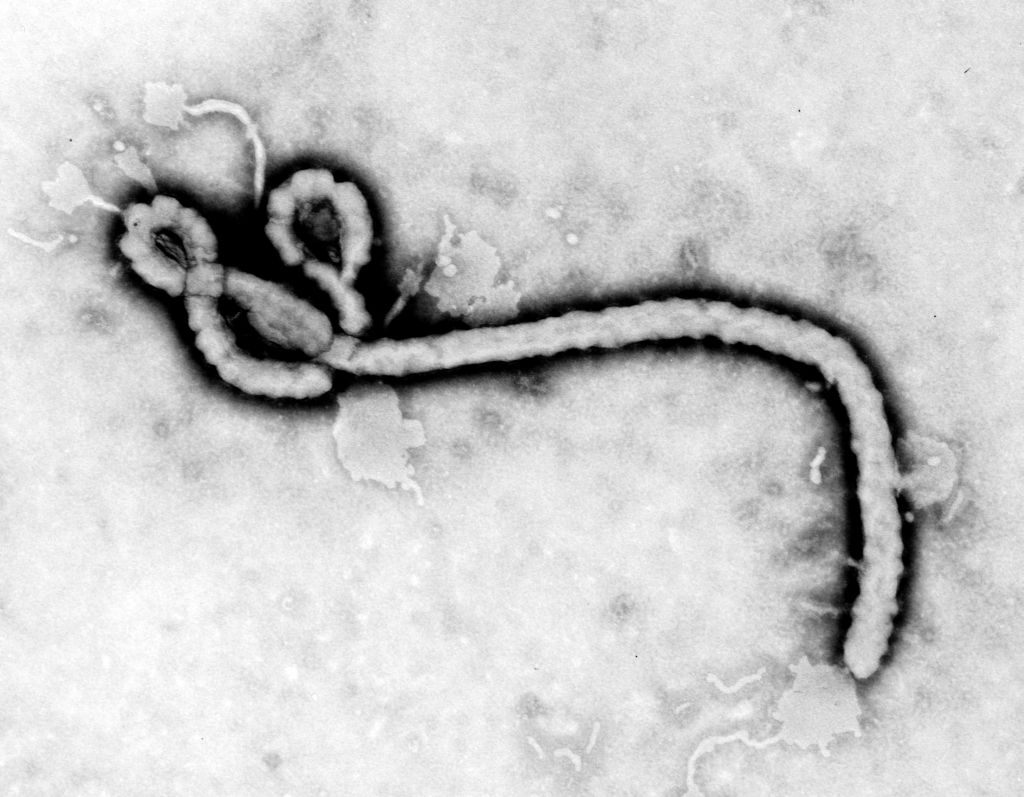 ebola