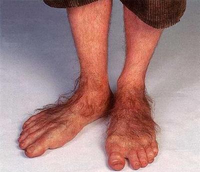 hobbit feet