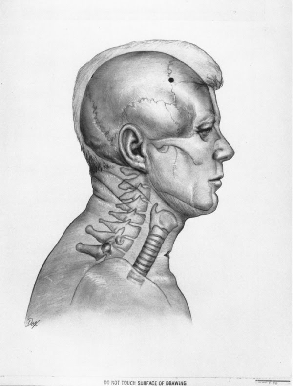 t13a075f22 jfk 20profile 20w 20wound 20s