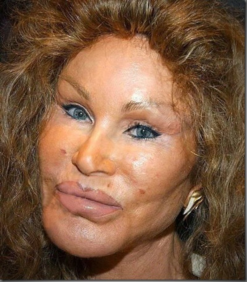 Bilder-Thread jocelyn-wildenstein-zuviele-gesichts-ops