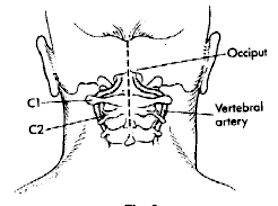 051 001 surgical fi9